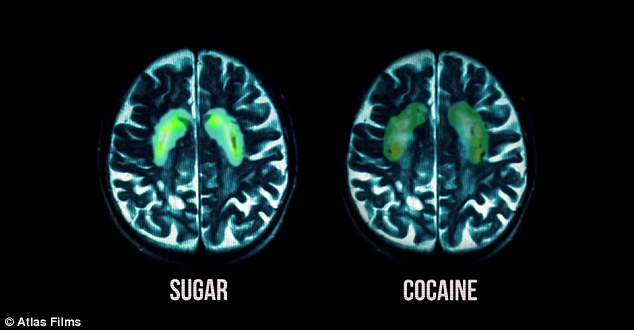 el-azucar-en-nuestro-cerebro
