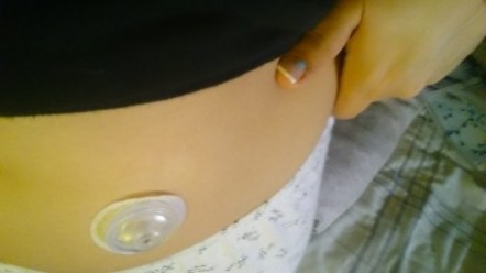 Probando el 1er i-Port Advance